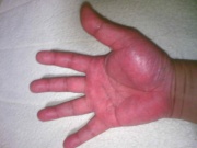 NowLoading...