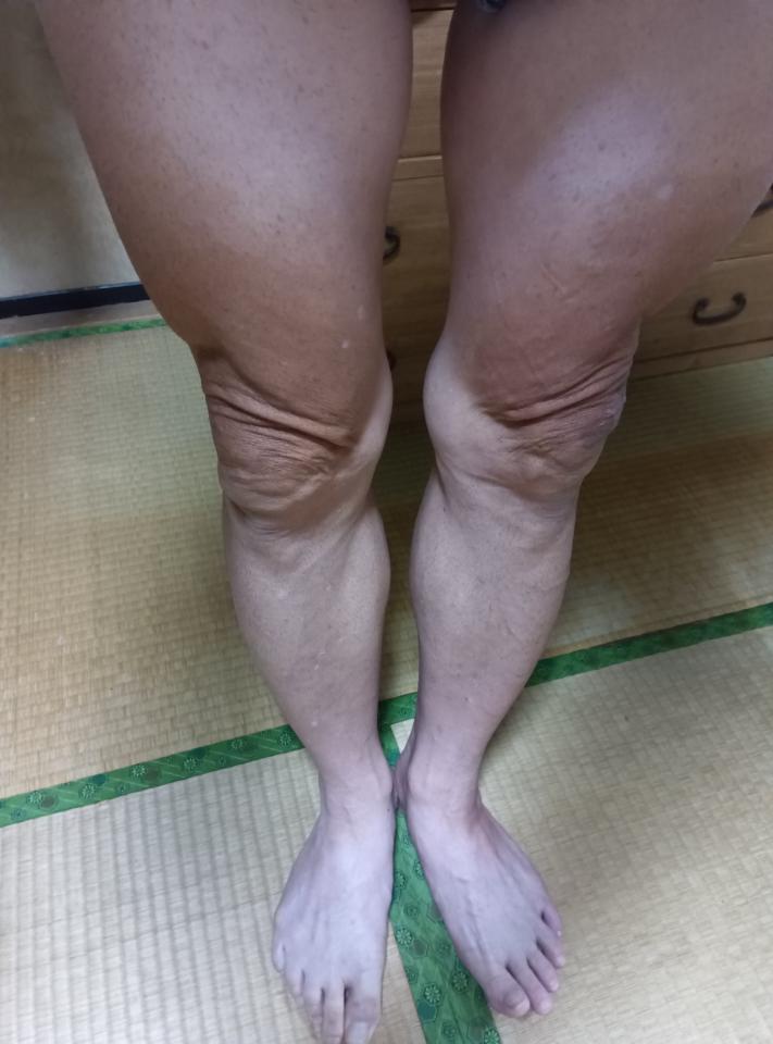 NowLoading...