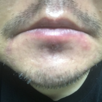 profile_image