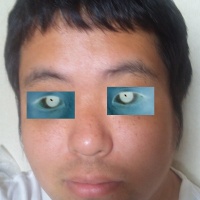 profile_image