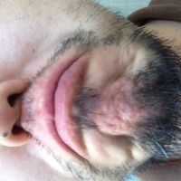 profile_image
